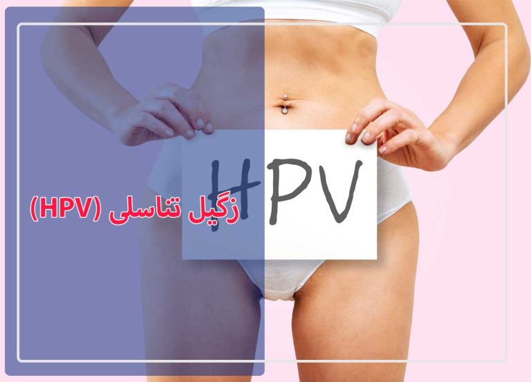 زگیل تناسلی